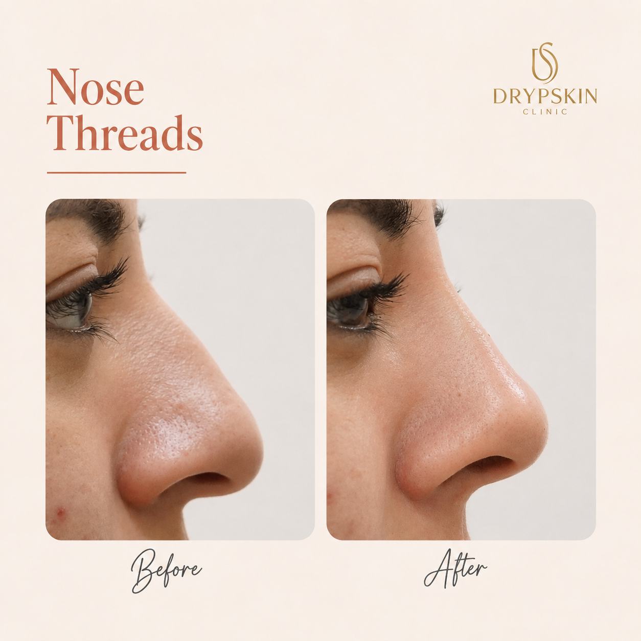 Drypskin Clinic 7