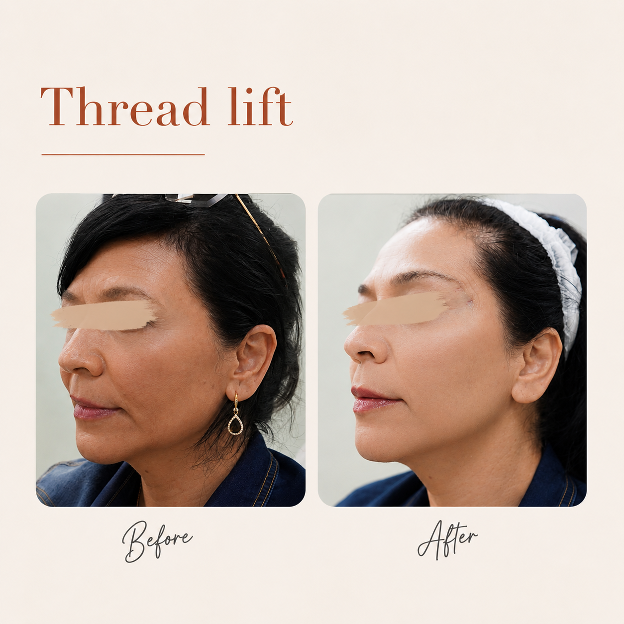Drypskin Clinic 8